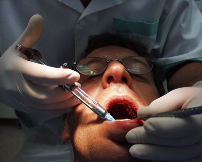 Roşcaţii se tem cel mai rău de dentist